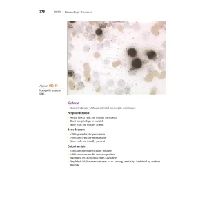 Anderson’s Atlas of Hematology (2-nd Edition). Shauna C. Anderson Young, Keila B. Poulsen