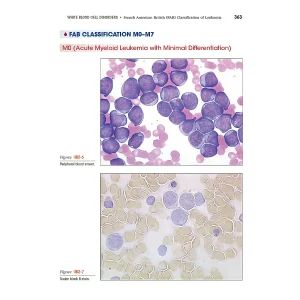 Clinical Hematology Atlas 6th Edition – Jacqueline Carr